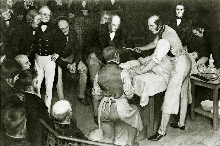 Teckning av kirurgen Robert Liston i färd med att utföra en amputation. 1830-tal. Teckning av kirurgen Robert Liston i färd med att utföra en amputation. 1830-tal.