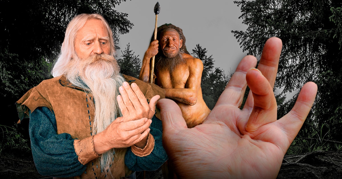 Nuova ricerca: la “malattia vichinga” è un segno dei geni di Neanderthal Nuova ricerca: la “malattia vichinga” è un segno dei geni di Neanderthal