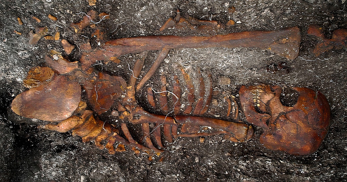 The oldest victim of syphilis in the world was found among tribal members The oldest victim of syphilis in the world was found among tribal members