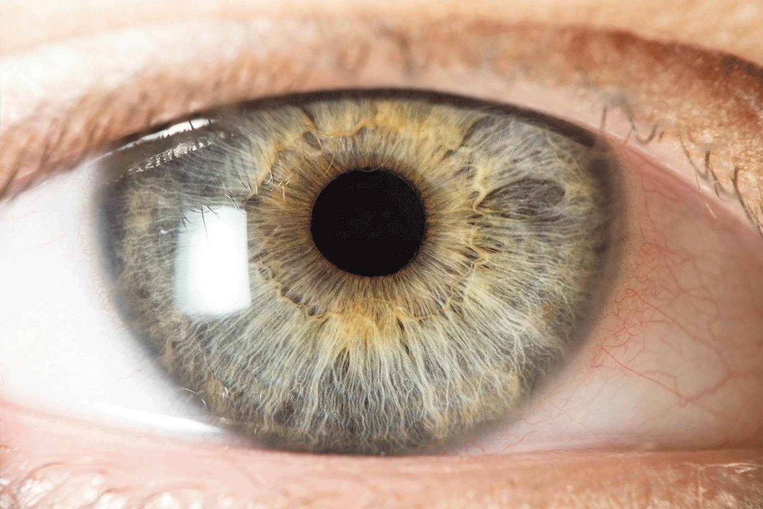Iris Iris