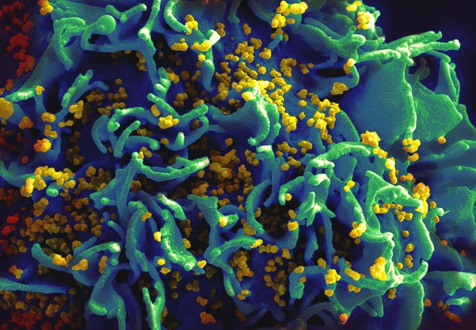 Infekterad T-cell Infekterad T-cell