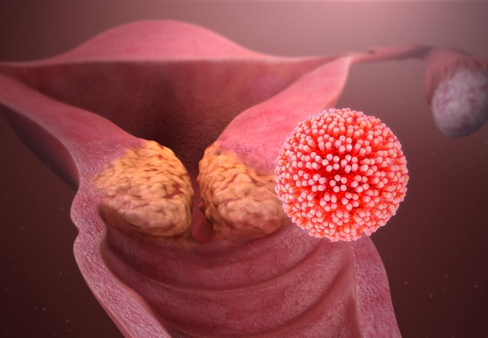 HPV HPV