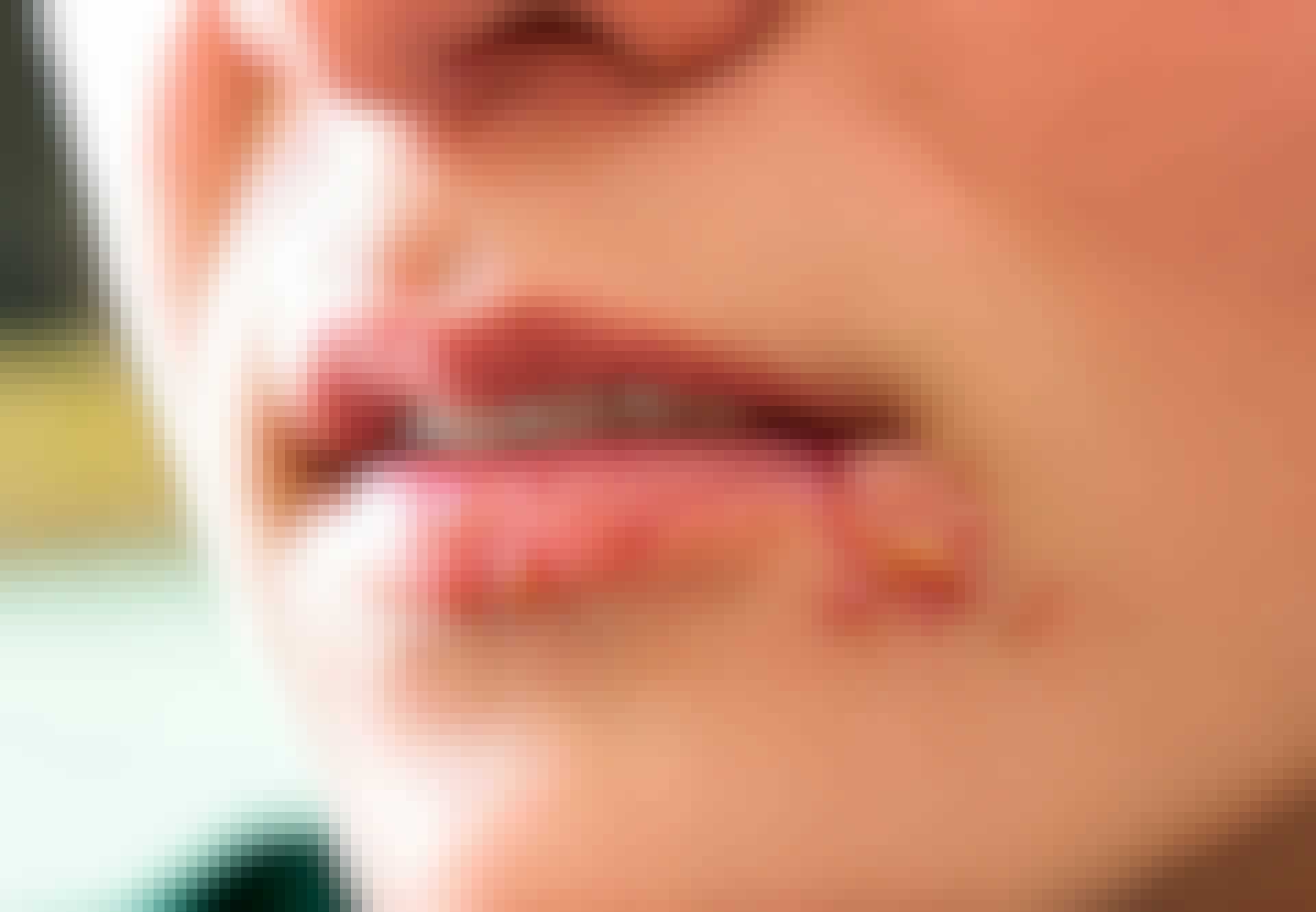 Herpes