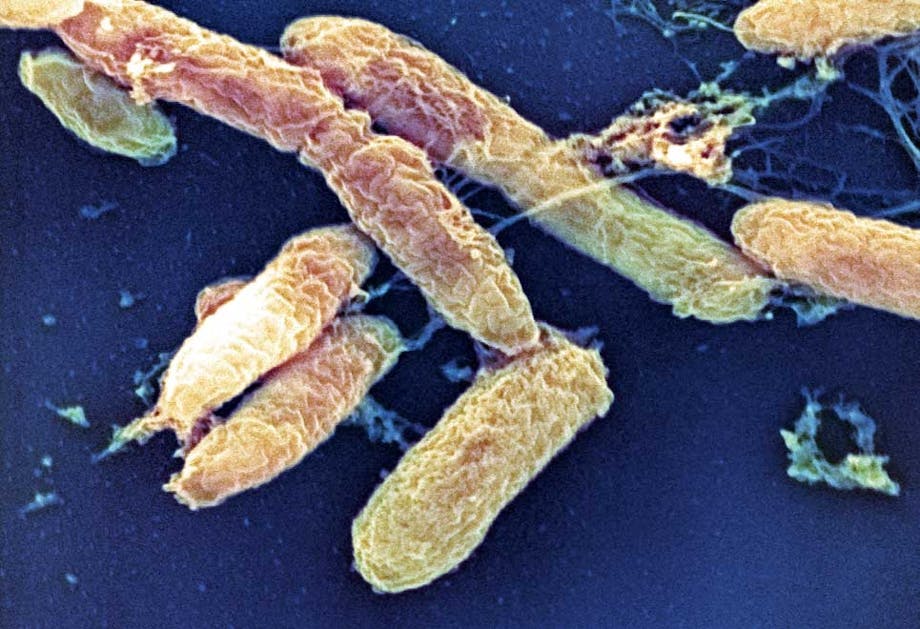 Epidemi - pest Epidemi - pest