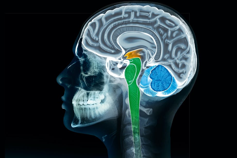 brain scan brain scan