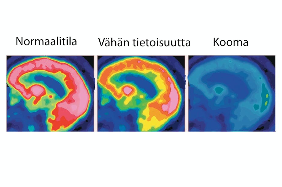 Brain scans Brain scans