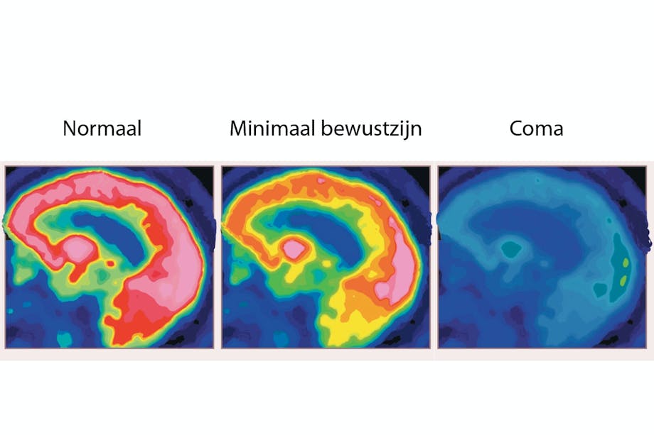 Brain scans Brain scans