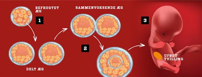 Skjult tvilling Skjult tvilling