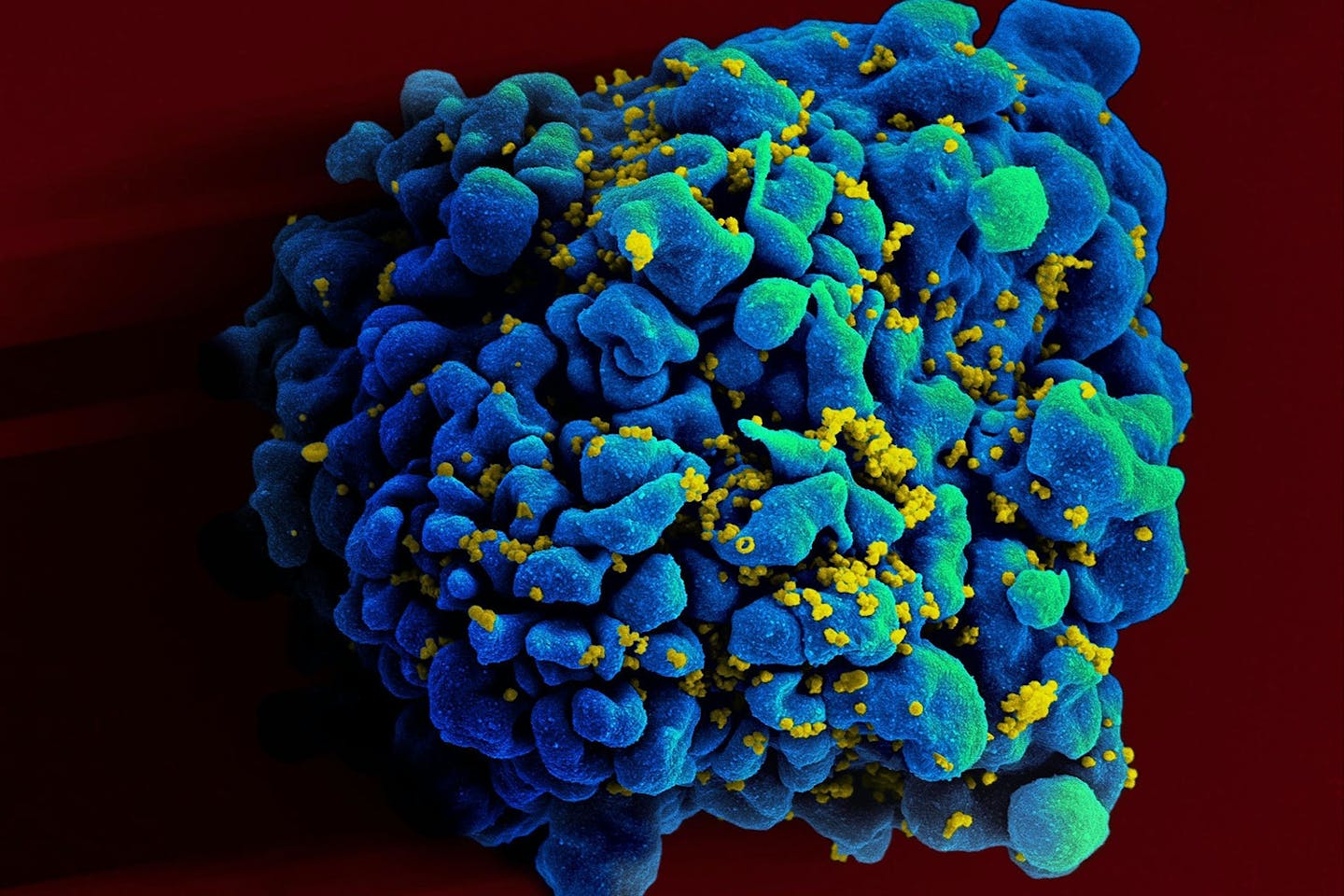 HIV-kur HIV-kur