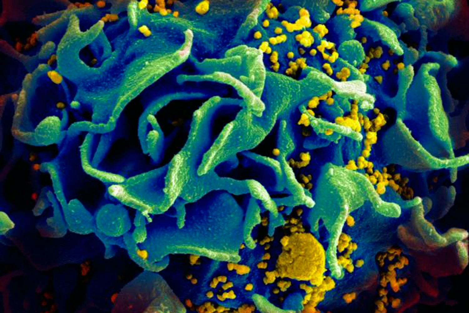 HIV-virus HIV-virus