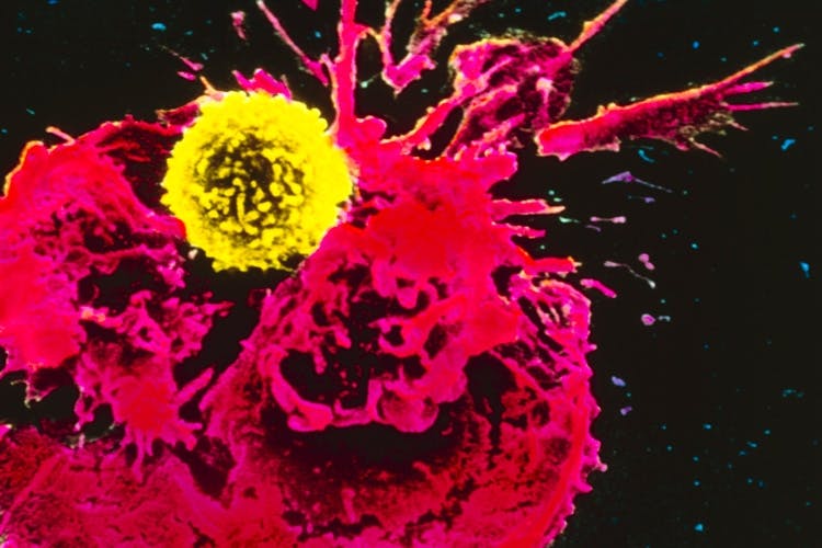 immunterapi t celle angriber immunterapi t celle angriber