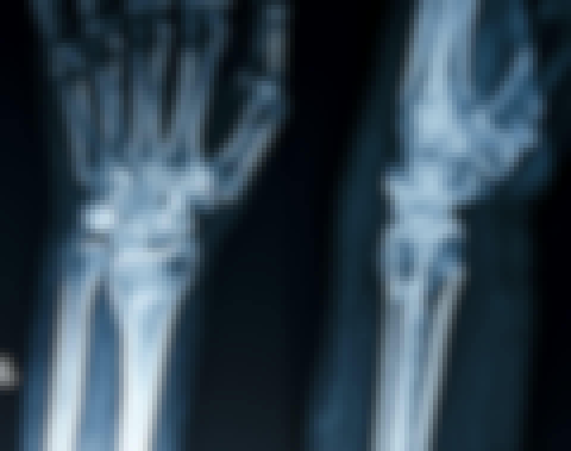 calcium
