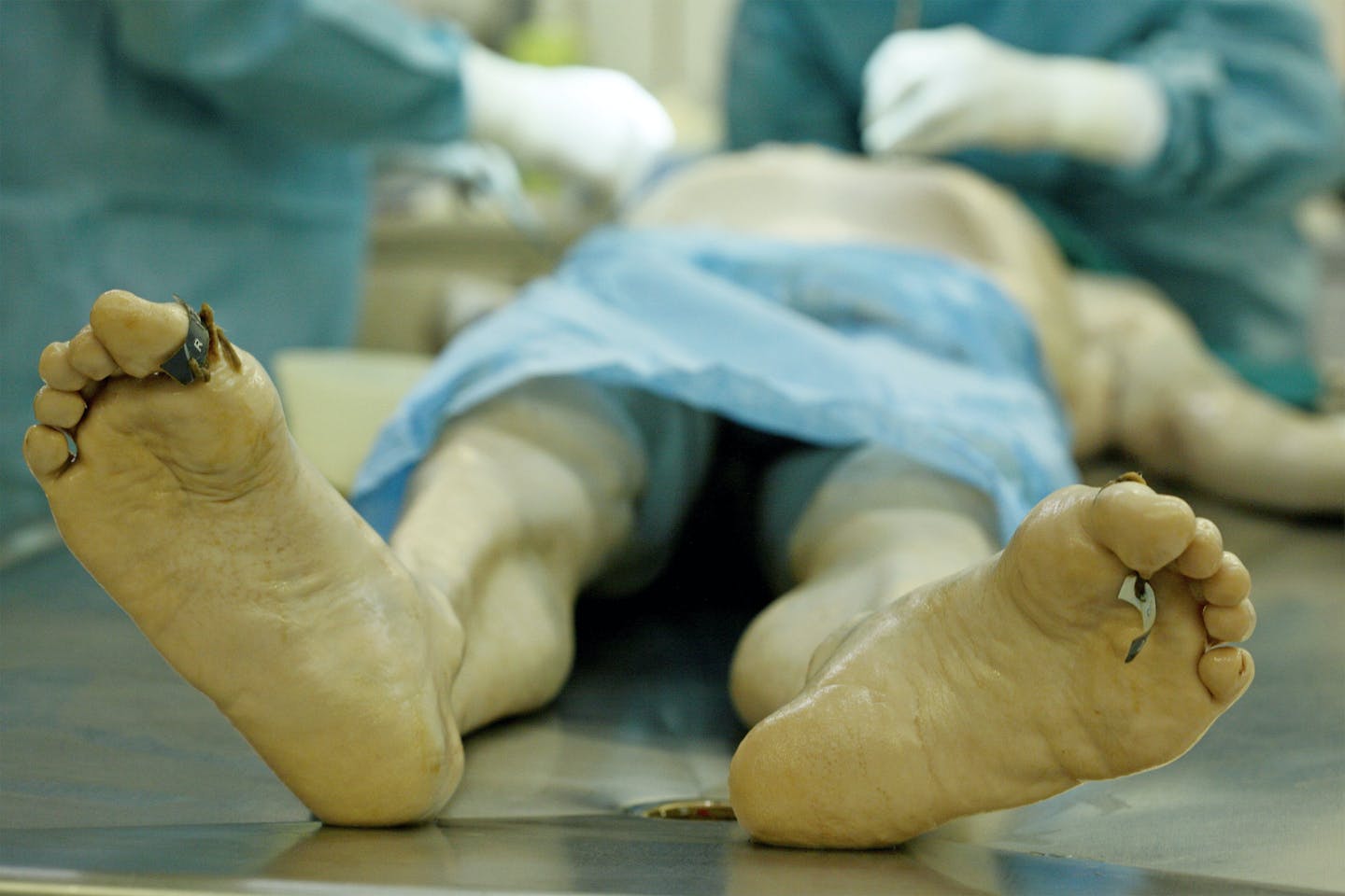 Dead body Dead body