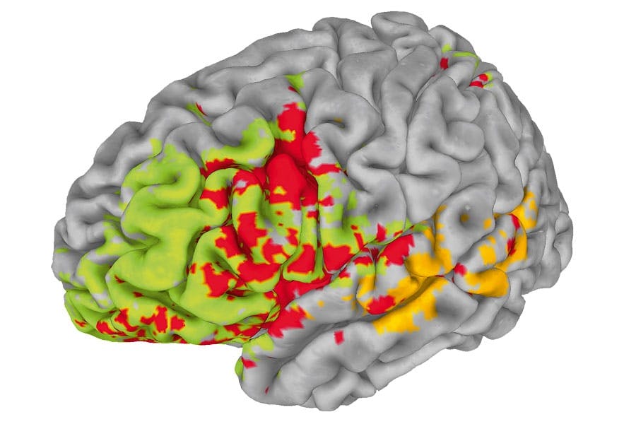 Brain areas Brain areas