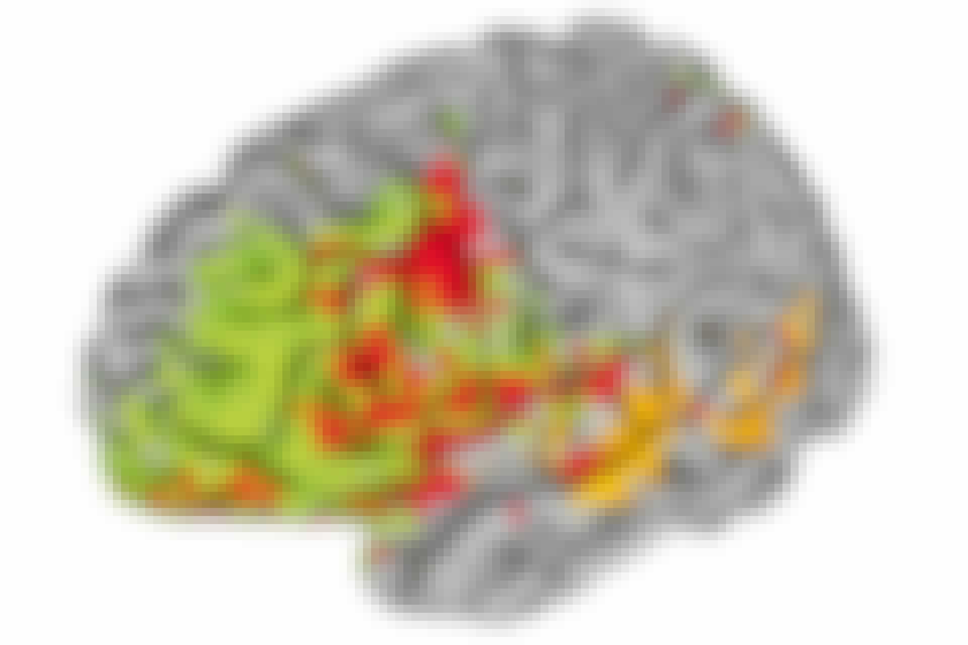 Brain areas