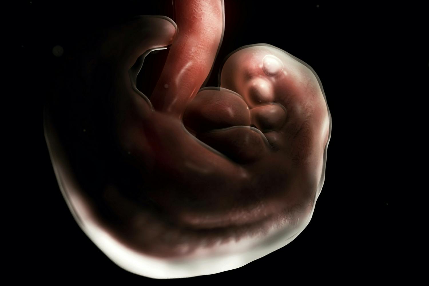 Foetus Foetus