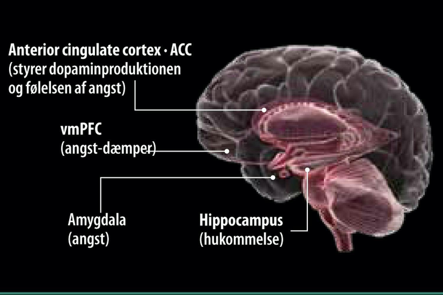 PTSD Brain PTSD Brain