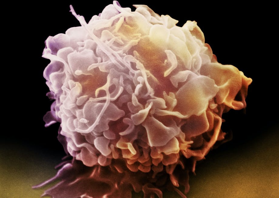 infectious microbe infectious microbe