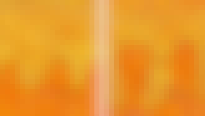 Psoriasis Psoriasis