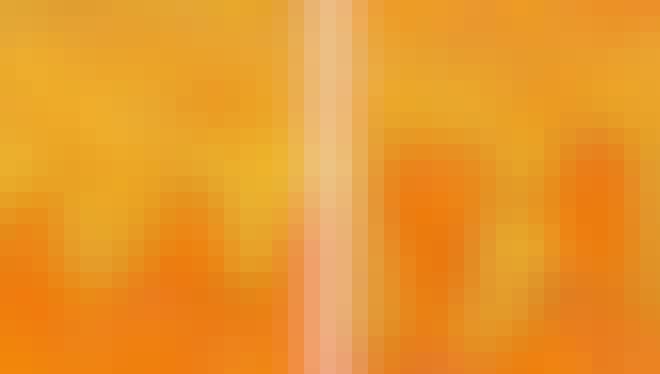 Psoriasis Psoriasis