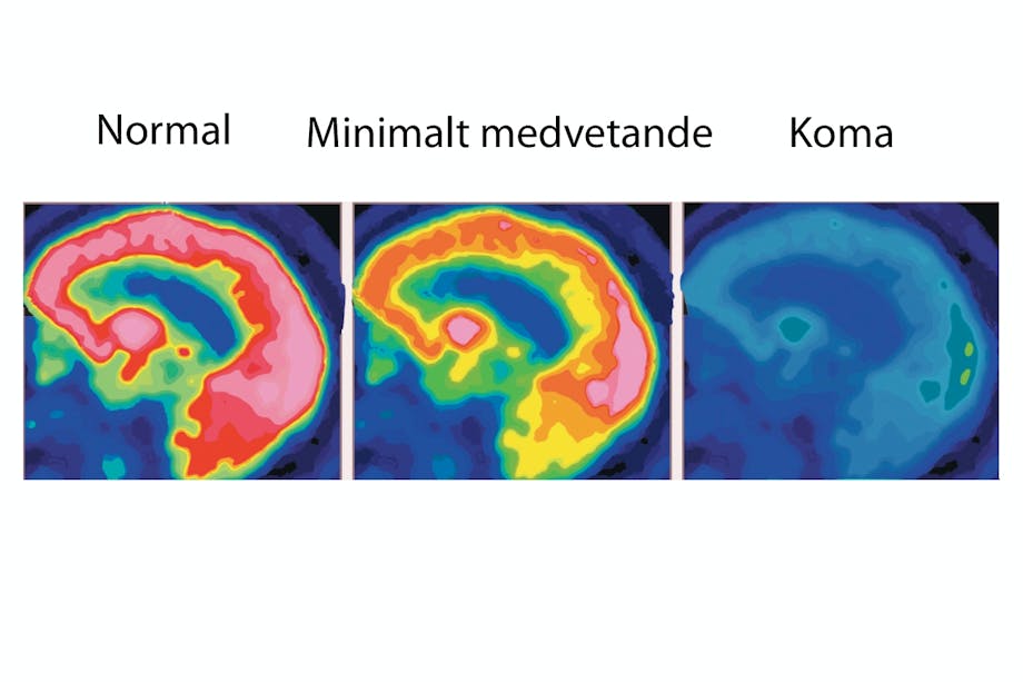 Brain scans Brain scans