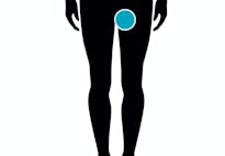 Fly og graviditet Fly og graviditet