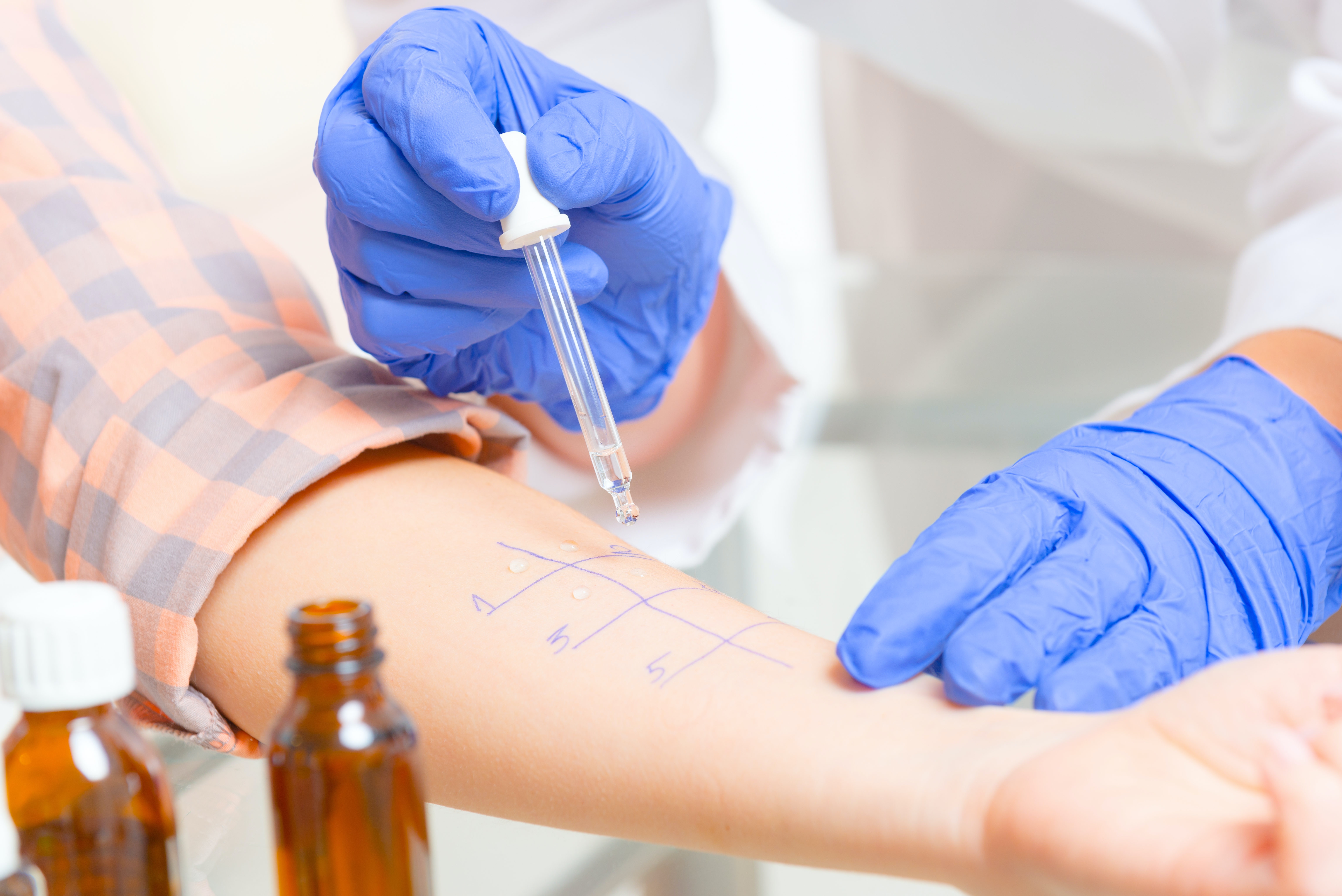 5 Merkwaardige Allergieen Wibnet Nl