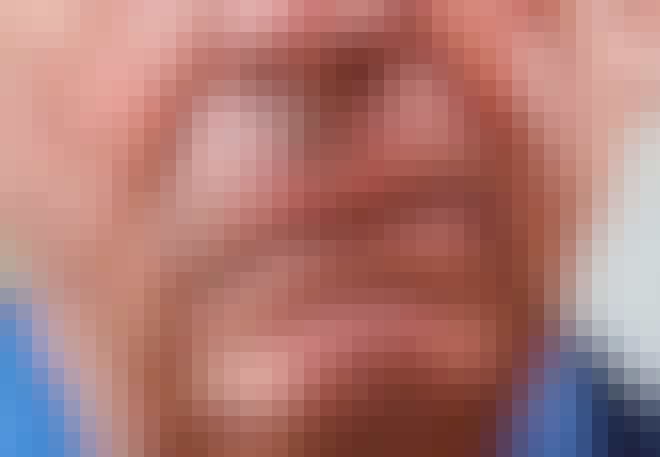 Man met letsel na beroerte Man met letsel na beroerte