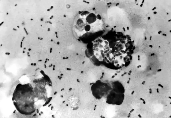 Epidemi - pest