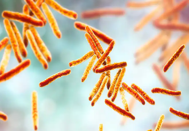 Epidemi - tuberkulose
