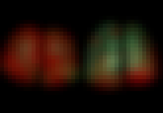 Langetermijneffecten van het coronavirus - Twee scans van longen met letsel van COVID-19 Langetermijneffecten van het coronavirus - Twee scans van longen met letsel van COVID-19