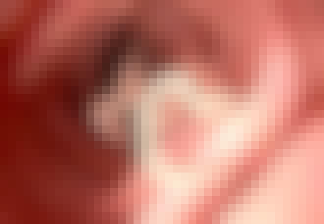Bendelorm inne i en tarm Bendelorm inne i en tarm