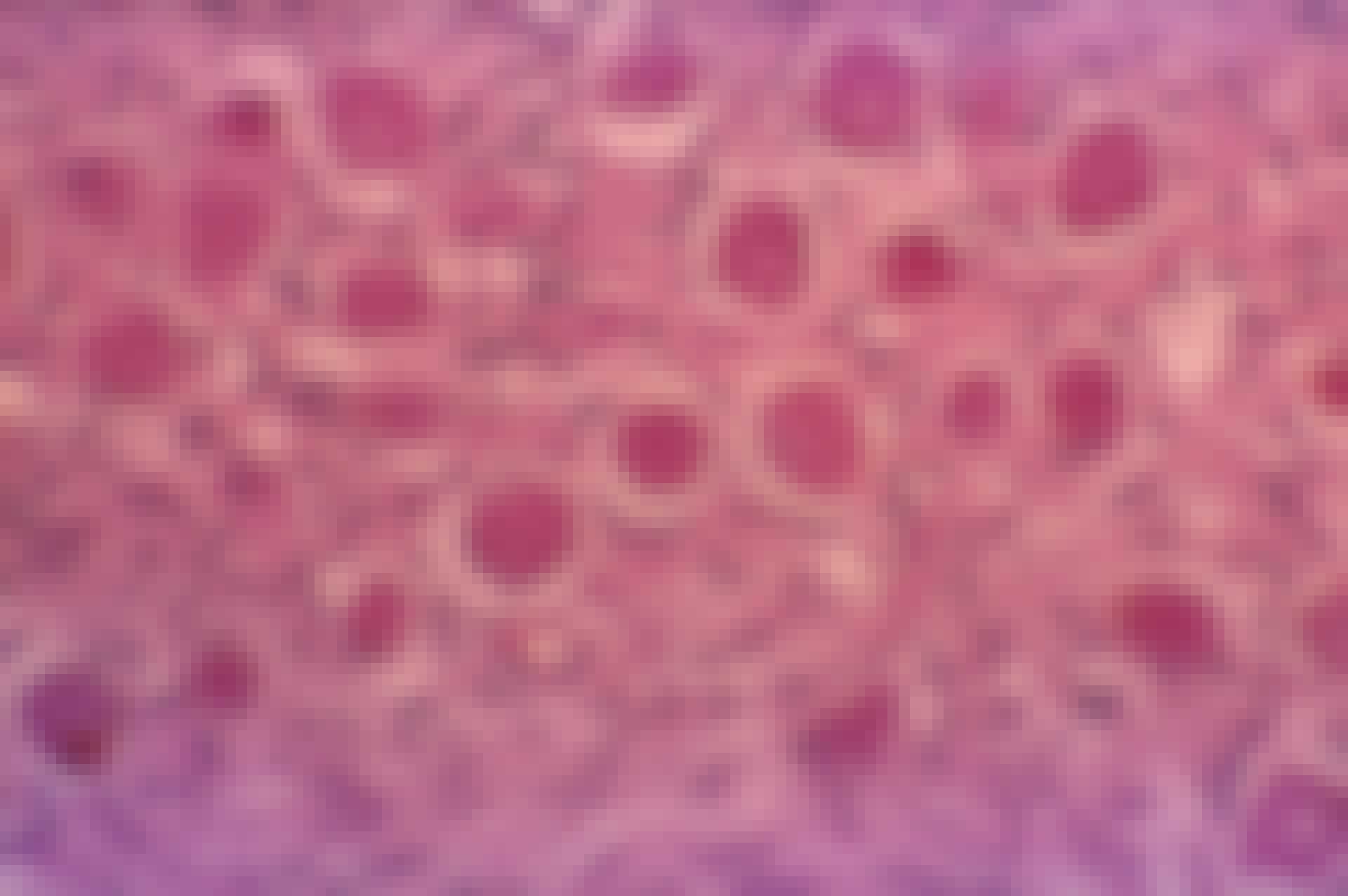 krooniset kivut, proteiinit, geeniterapia, crispr krooniset kivut, proteiinit, geeniterapia, crispr