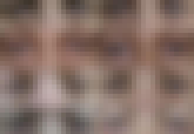 Ennen silmäluomien korjausleikkausta ja sen jälkeen Ennen silmäluomien korjausleikkausta ja sen jälkeen