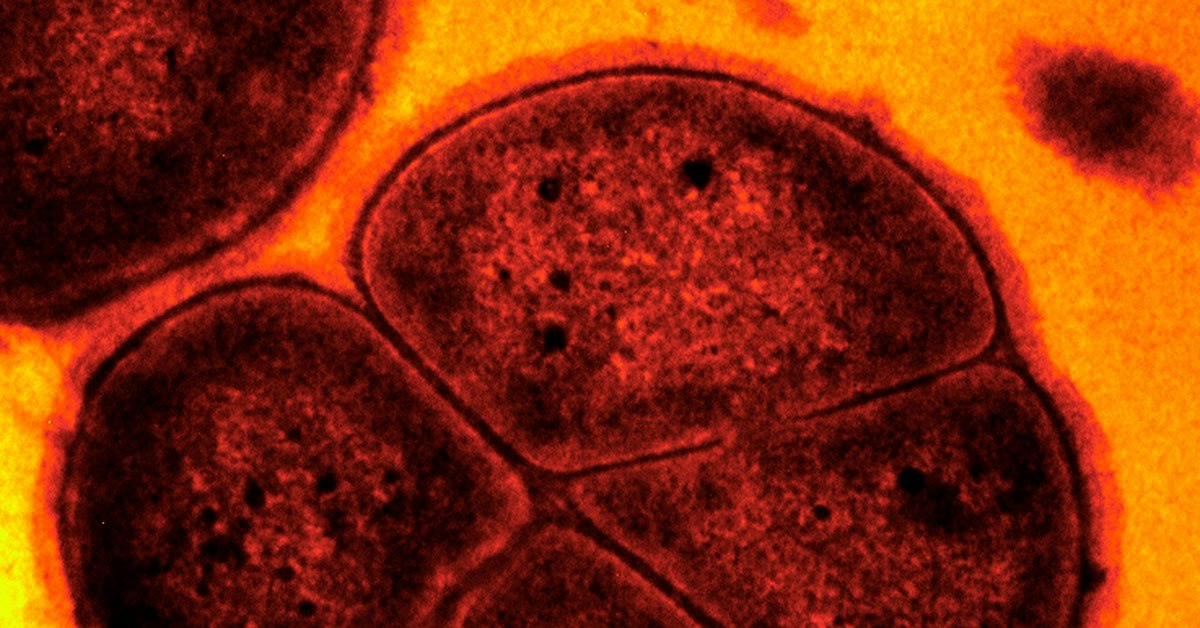 Hemmeligheten bak den udødelige superbakterien Deinococcus radiodurans ...