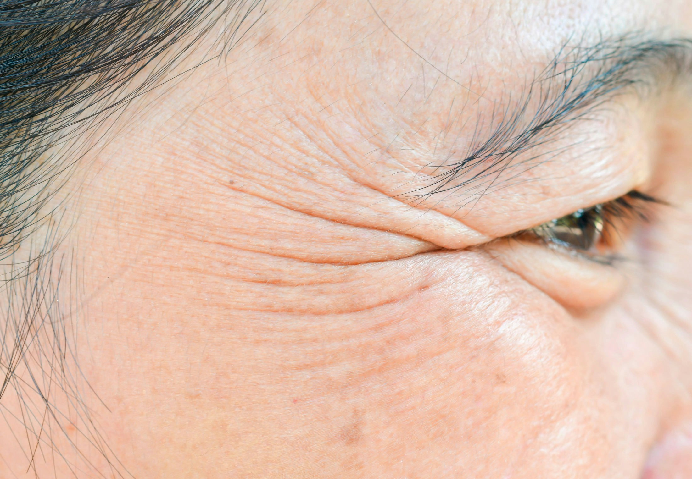 “The Surprising Theory: Wrinkles May Be the Cause of Aging, Not Just a Sign of It”