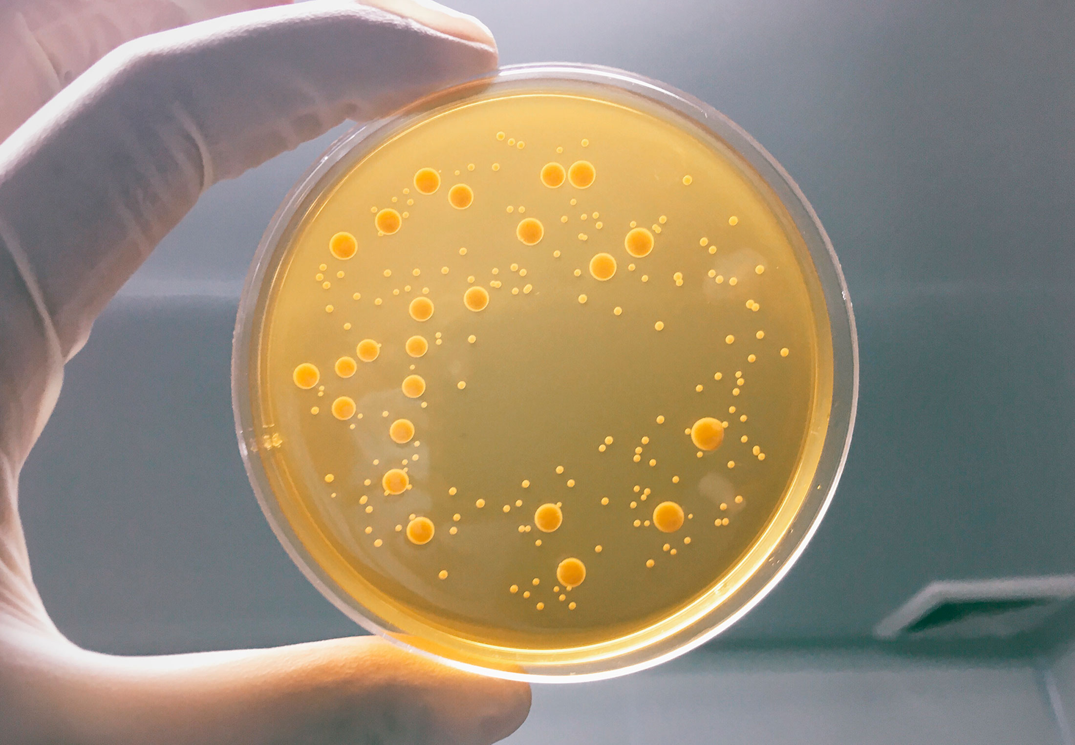 Iigala Voedingsbodem Agar-kit – 10 Apart Verzegelde Petrischalen Met Wattenstaven – Voor Thuis Schimmel- En Bacterietesten – Snelle Resultaten Binnen 48 Uur