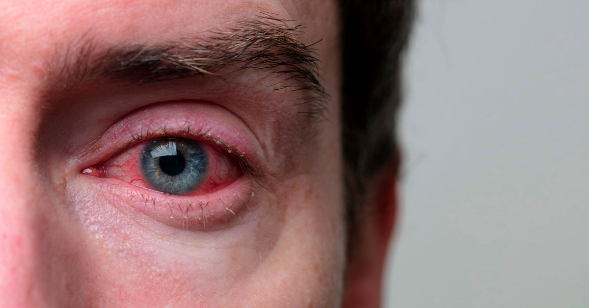 The study contradicts common belief about allergies The study contradicts common belief about allergies