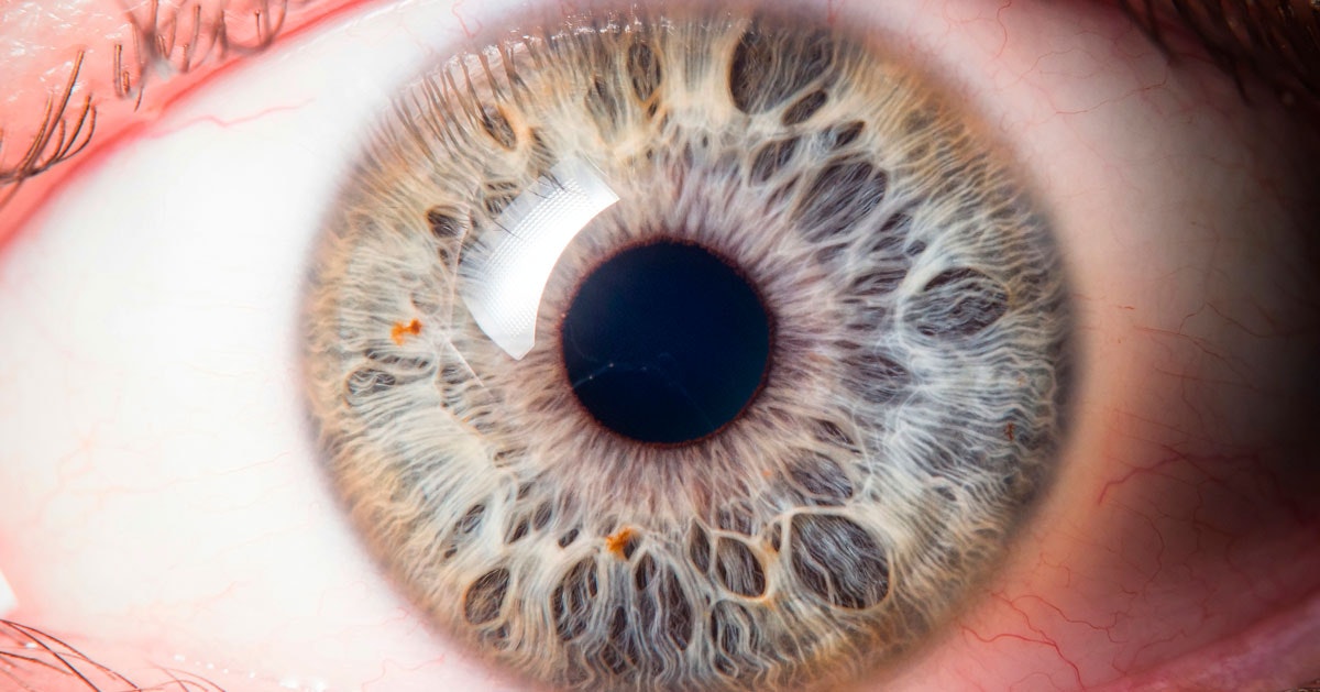 Nuova scoperta: gli occhi possono rilevare precocemente malattie gravi Nuova scoperta: gli occhi possono rilevare precocemente malattie gravi