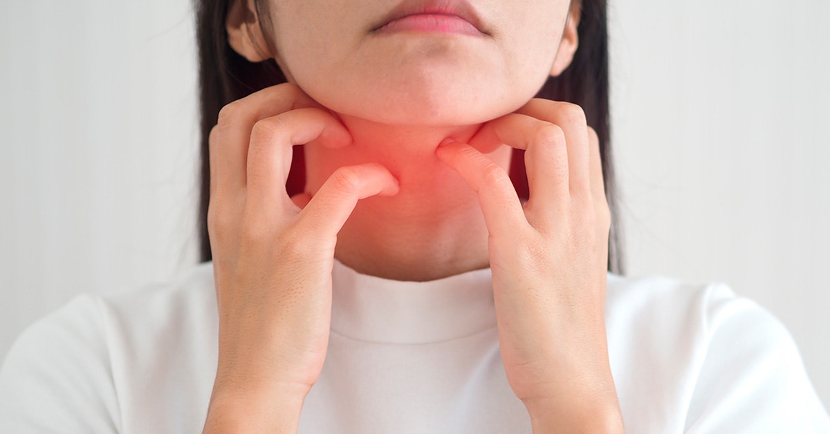 Tutkimus Tuttu lääke voi helpottaa ruokaaineallergiaa tieku.fi