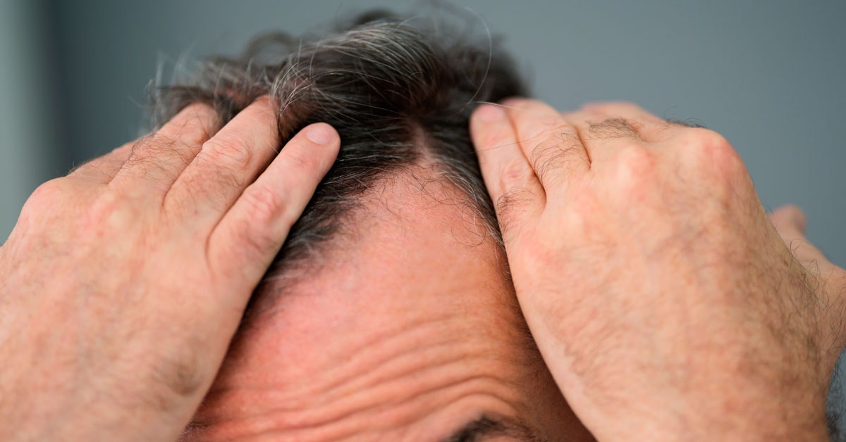 Questa scoperta può ripristinare la crescita dei capelli nei topi Questa scoperta può ripristinare la crescita dei capelli nei topi