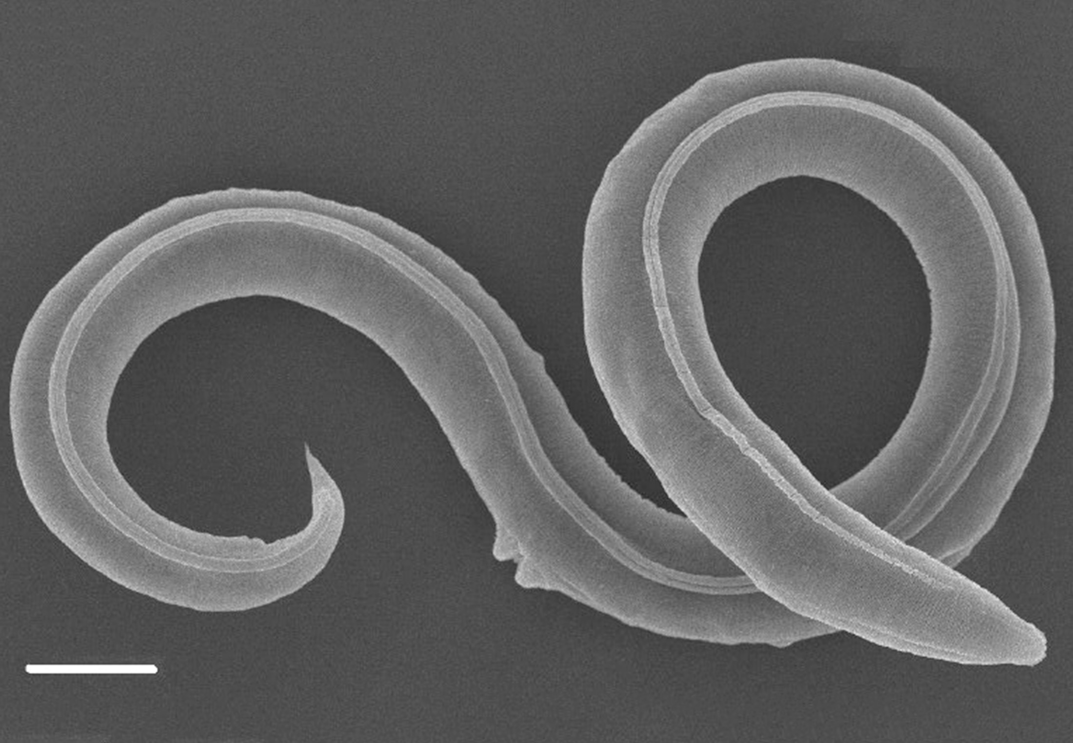 0 46. Микроскопические черви Nematoda. Червь нематода Земляной.